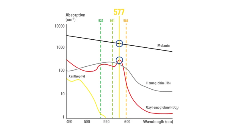 577nm-yellow-laser-wavelength-1-63bbee5530b44006987122.webp