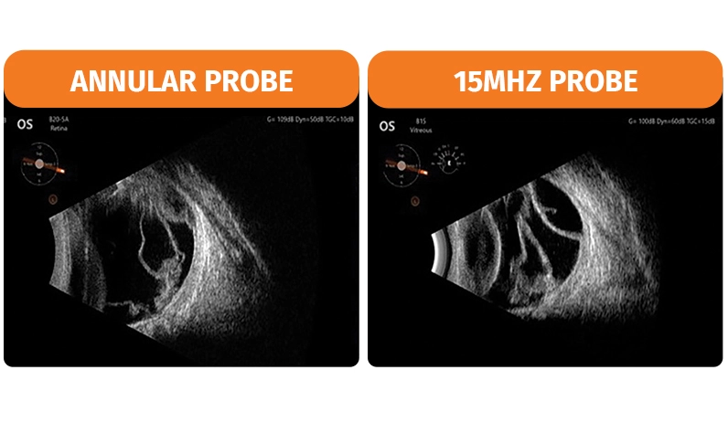 annular-probe-vs-15mhz-2-63cfcfbf1329a982267311.webp