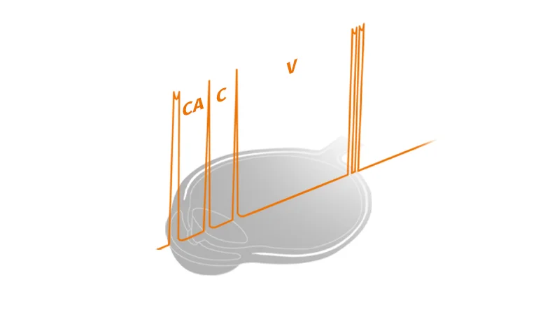 measurement-precision-2-63bbdd3d7fd7e042093560.webp