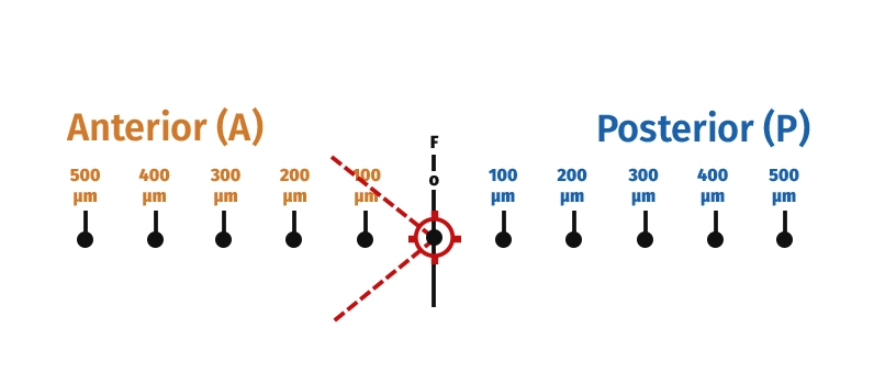 wide-range-anterior-and-posterior-offset-63f8c89941f96786171021.webp