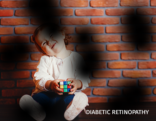 /uploads/images/pathologies/diabetic-retinopathy-patho-63bd24637934b041394193-649edd352d1a9057124737.png