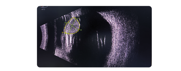 b mode scan