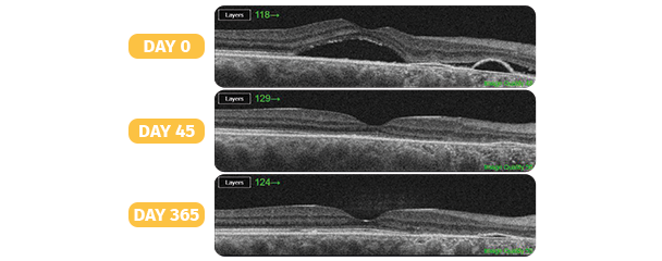 <p>SubLiminal<strong>®</strong> Laser Therapy</p>