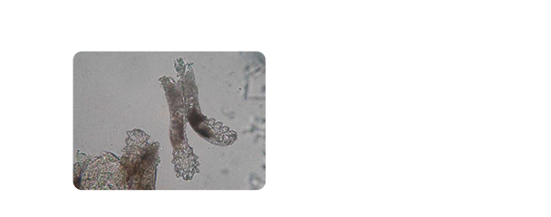 demodex4 63b40e28097f1040146563
