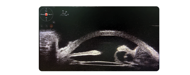 ubm scan