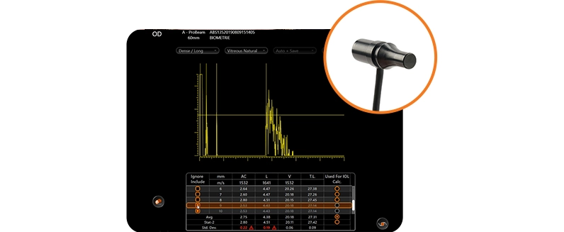 sonde-biometrie-63a310b7c648f633271655-64a2b0e83f1be717962827.webp