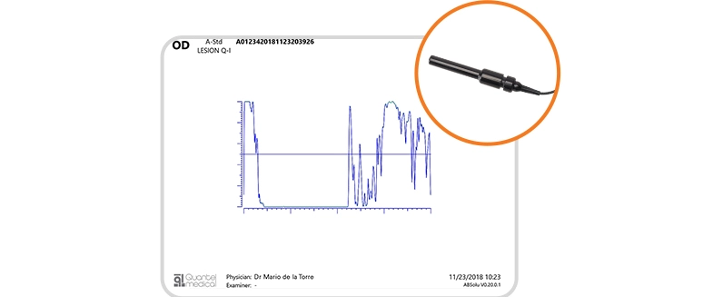 sonde-standardisee-63a310b7c6b60935286630-64a2b0e8407b7060960590.webp