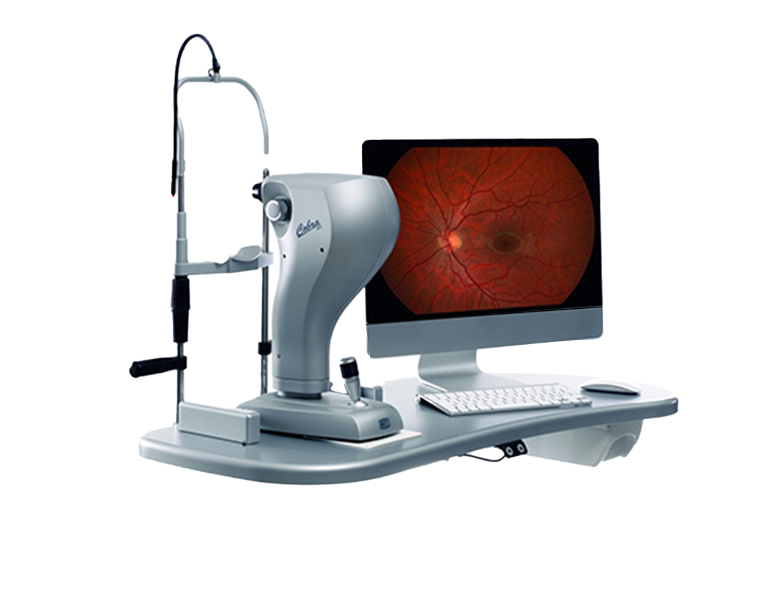 5ebab03bc8431-fundus-kamera-cobra-hd-64be8919360b4441824629.png